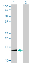 Western blot of RPA3 expression in transfected 293T cell line by RPA3 monoclonal antibody (M01), clone 1F4.