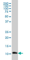 RPA3 monoclonal antibody (M01), clone 1F4 Western blot of RPA3 expression in HL-60.