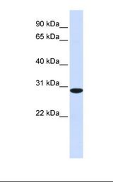 Fetal muscle lysate. Antibody concentration: 1.0 ug/ml. Gel concentration: 12%.