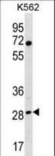 RPA4 Antibody western blot of K562 cell line lysates (35 ug/lane). The RPA4 antibody detected the RPA4 protein (arrow).