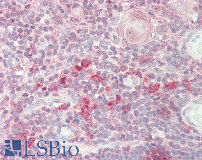 Human Thymus: Formalin-Fixed, Paraffin-Embedded (FFPE)