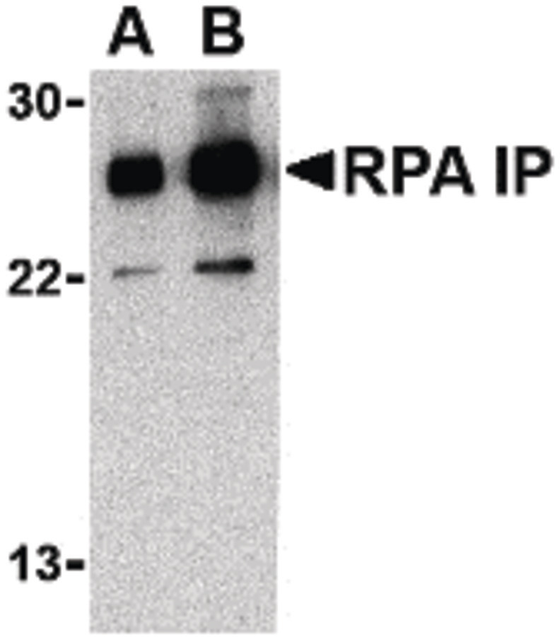 Western blot of RPA Interacting Protein in Jurkat cell lysate with RPA Interacting Protein antibody at (A) 0.5 and (B) 1 ug/ml.