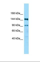 Western blot of Fetal Kidney. Ndufaf5 antibody dilution 1.0 ug/ml.
