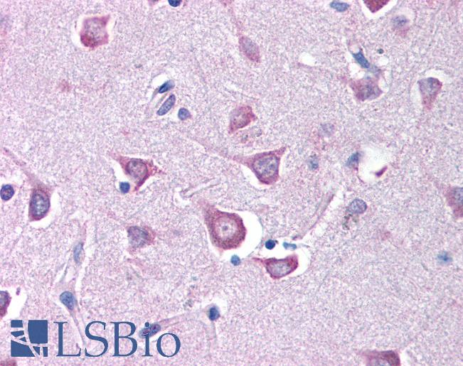 Anti-RPE65 antibody IHC of human brain cortex. Immunohistochemistry of formalin-fixed, paraffin-embedded tissue after heat-induced antigen retrieval. Antibody LS-B90 concentration 5 ug/ml.
