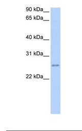 Jurkat cell lysate. Antibody concentration: 2.0 ug/ml. Gel concentration: 12%.