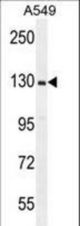 RPGR Antibody western blot of A549 cell line lysates (35 ug/lane). The RPGR antibody detected the RPGR protein (arrow).
