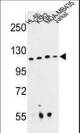 Western blot of RPGRIP1 Antibody in HL-60, K562, MDA-MB435, Jurkat cell line lysates (35 ug/lane). RPGRIP1 (arrow) was detected using the purified antibody.
