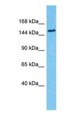 Western blot of FTM Antibody with human 293T Whole Cell lysate.