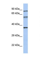 RPH3A / Rabphilin 3A antibody LS-C112323 Western blot of Small Intestine lysate. Antibody concentration 1 ug/ml.