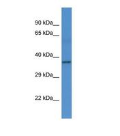 Western blot of Human Fetal Heart. RPH3A antibody dilution 1.0 ug/ml.