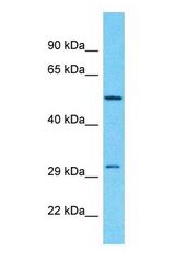 Western blot of RPH3AL Antibody with 293T Whole Cell lysate.