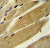 RPH3AL Antibody immunohistochemistry of formalin-fixed and paraffin-embedded human skeletal muscle followed by peroxidase-conjugated secondary antibody and DAB staining.