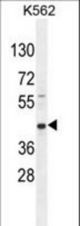 RPH3AL Antibody western blot of K562 cell line lysates (35 ug/lane). The RPH3AL antibody detected the RPH3AL protein (arrow).