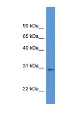 RPIA antibody LS-C145282 Western blot of Mouse Pancreas lysate. Antibody concentration 1 ug/ml.