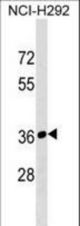 RPIA Antibody western blot of NCI-H292 cell line lysates (35 ug/lane). The RPIA antibody detected the RPIA protein (arrow).