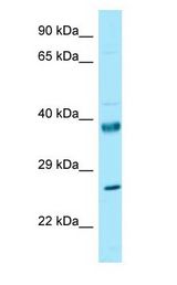 RPL10 / L10 antibody Western Blot of Fetal Liver.
