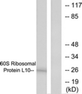 Western blot of extracts from K562 cells, treated with Insulin 0.01u/ml 15min, using 60S Ribosomal Protein L10 Antibody. The lane on the right is treated with the synthesized peptide.