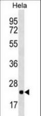 RPL10 Antibody western blot of HeLa cell line lysates (35 ug/lane). The RPL10 antibody detected the RPL10 protein (arrow).