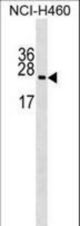 RPL10A Antibody western blot of NCI-H460 cell line lysates (35 ug/lane). The RPL10A antibody detected the RPL10A protein (arrow).