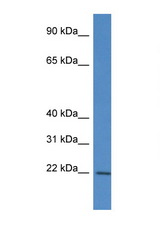 RPL12 antibody LS-C145420 Western blot of Fetal Brain lysate. Antibody concentration 1 ug/ml.