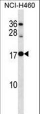 RPL12 Antibody western blot of NCI-H460 cell line lysates (35 ug/lane). The RPL12 antibody detected the RPL12 protein (arrow).