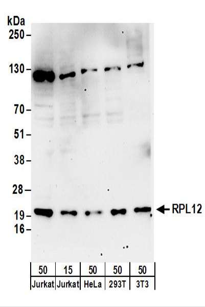 Detection of Human and Mouse RPL12 by Western Blot. Samples: Whole cell lysate from Jurkat (15 and 50 ug), HeLa (50 ug), 293T (50 ug), and mouse NIH3T3 , (50 ug) cells. Antibodies: Affinity purified rabbit anti-RPL12 antibody used for WB at 0.4 ug/ml. Detection: Chemiluminescence with an exposure time of 3 minutes.