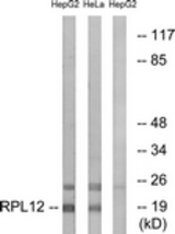 Western blot of extracts from HepG2/HeLa cells, using RPL12 Antibody. The lane on the right is treated with the synthesized peptide.