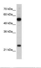 HepG2 Cell Lysate