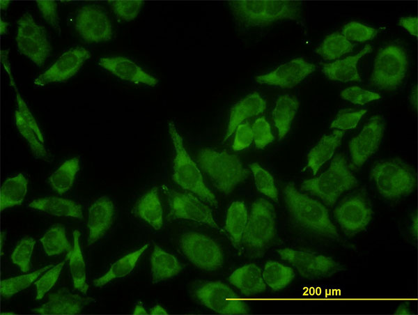 Immunofluorescence of monoclonal antibody to RPL13 on HeLa cell. [antibody concentration 10 ug/ml]