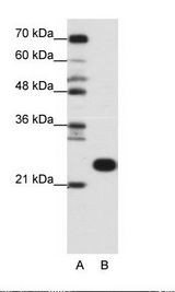 B: Jurkat Cell Lysate
