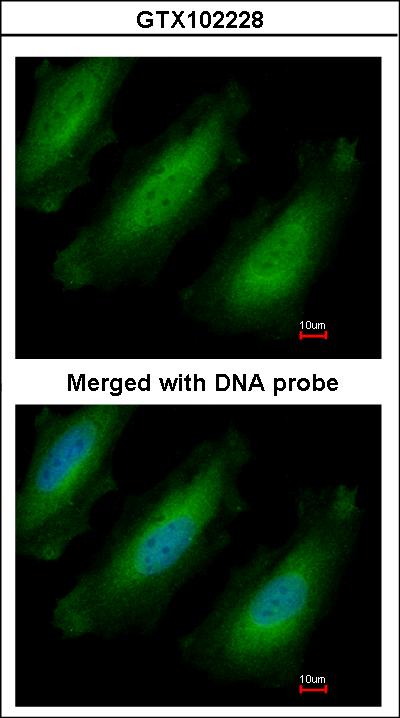Immunofluorescence of paraformaldehyde-fixed HeLa using RPL13A antibody at 1:200 dilution.