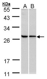 Sample (30 ug of whole cell lysate). A:293T, B: HeLa. 10% SDS PAGE. RPL13A antibody diluted at 1:500