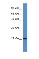 RPL14 antibody LS-C145414 Western blot of Fetal Kidney lysate. Antibody concentration 1 ug/ml.