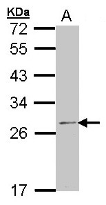 Sample (30 ug of whole cell lysate). A:293T. 12% SDS PAGE. RPL14 antibody diluted at 1:1000.