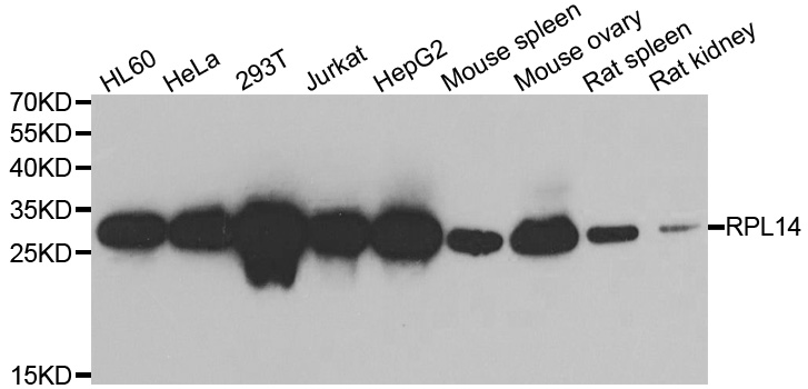 Western blot analysis of extracts of various cell lines, using RPL14 antibody.