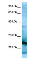 RPL15 / L15 antibody Western Blot of HepG2.