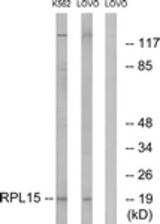 Western blot of extracts from LOVO/K562 cells, using RPL15 Antibody. The lane on the right is treated with the synthesized peptide.