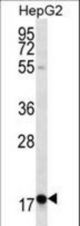 RPL15 Antibody western blot of HepG2 cell line lysates (35 ug/lane). The RPL15 antibody detected the RPL15 protein (arrow).
