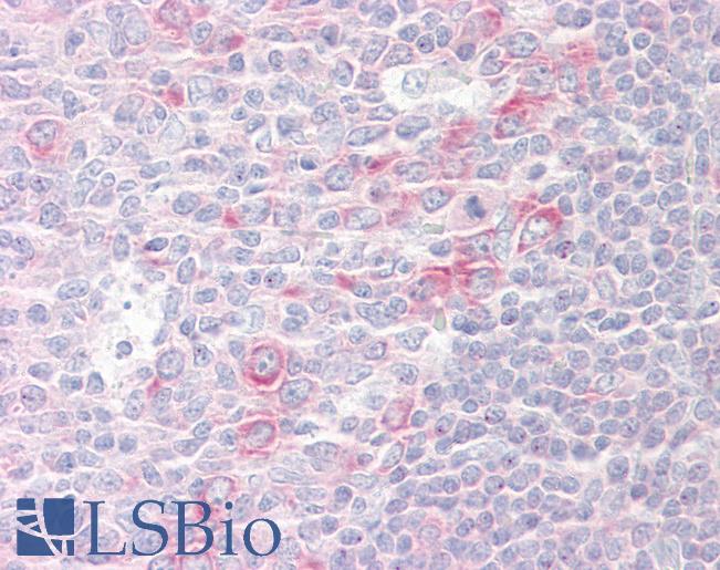 Anti-RPL17 antibody IHC of human tonsil. Immunohistochemistry of formalin-fixed, paraffin-embedded tissue after heat-induced antigen retrieval. Antibody LS-B7683 dilution 10 ug/ml.