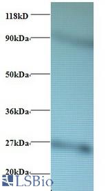 Western blot of 60S ribosomal protein L17 antibody at 2 ug/ml + EC109whole cell lysate. Secondary: Goat polyclonal to Rabbit IgG at 1:15000 dilution. Predicted band size: 20 kDa. Observed band size: 27 kDa Additional bands at: 80 kDa. We are unsure as to the identity of this extra band.