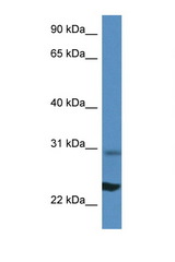 RPL17 antibody LS-C135372 Western blot of Mouse Liver lysate. Antibody concentration 1 ug/ml.