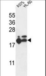 RPL17 Antibody western blot of A375,HL-60 cell line lysates (35 ug/lane). The RPL17 antibody detected the RPL17 protein (arrow).