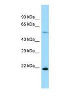 Western blot of Rpl17 Antibody - C-terminal region in Rat Pancreas cells lysate.