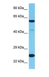 Western blot of RPL18 Antibody with human HeLa Whole Cell lysate.