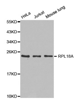 Western blot analysis of extracts of various cell lines, using RPL18A antibody.