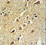 Formalin-fixed and paraffin-embedded human brain tissue reacted with RPL18A Antibody , which was peroxidase-conjugated to the secondary antibody, followed by DAB staining. This data demonstrates the use of this antibody for immunohistochemistry; clinical relevance has not been evaluated.