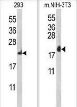 Western blot of RPL18A Antibody in HeLa, 293 cell line lysates (35 ug/lane). RPL18A (arrow) was detected using the purified antibody.