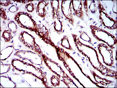 IHC of paraffin-embedded kidney tissues using RPL18A mouse monoclonal antibody with DAB staining.