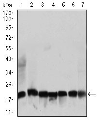 Western blot using RPL18A mouse monoclonal antibody against NIH3T3 (1), HEK293 (2), HL60 (3), Jurkat (4), Raji (5), MOLT4 (6), and HeLa (7) cell lysate.