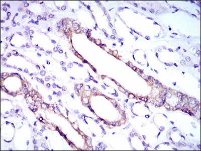 IHC of paraffin-embedded kidney tissues using RPL18A mouse monoclonal antibody with DAB staining.